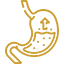 Gastric Bypass